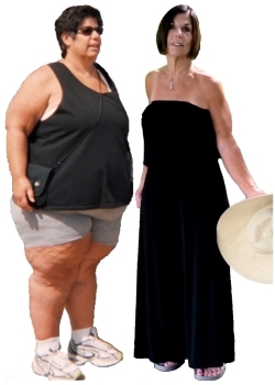Health After Weight Loss Surgery