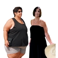 Pointers from a Long Term Weight Loss surgery Patient