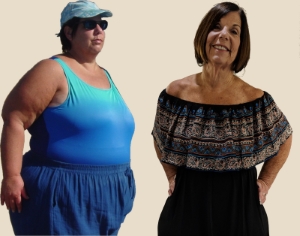 A 14 Year Post-Op Weight Loss Surgery Patient